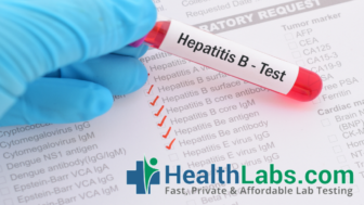 Healthlabs Hepatitis B Surface Antigen Test